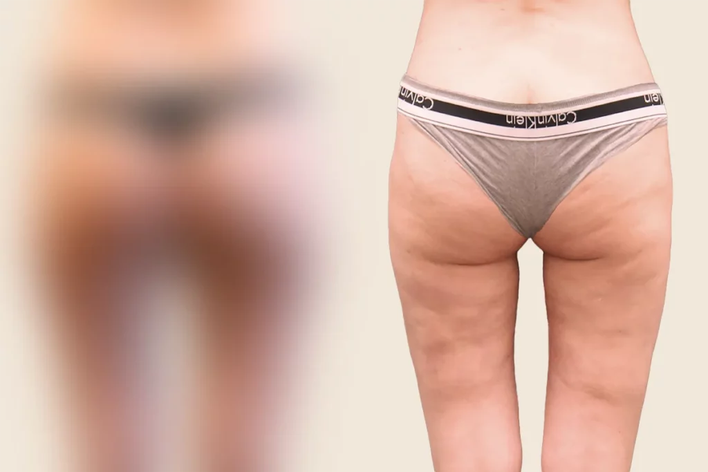 drberkei before after 35 2